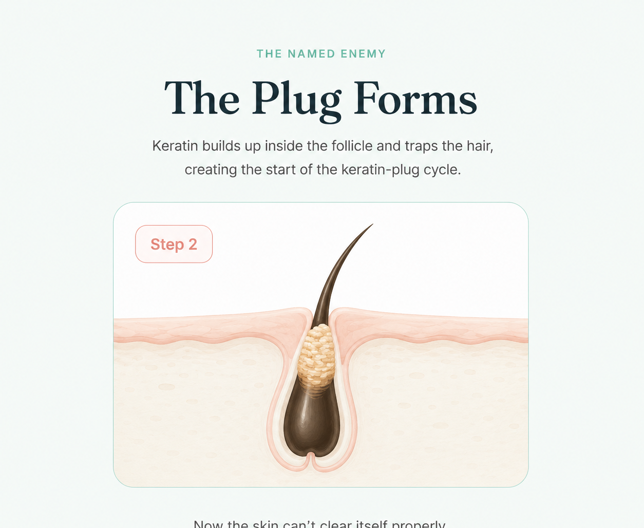 Step 2: the plug forms diagram