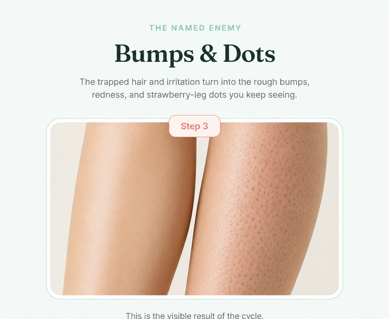 Step 3: bumps and dots on skin