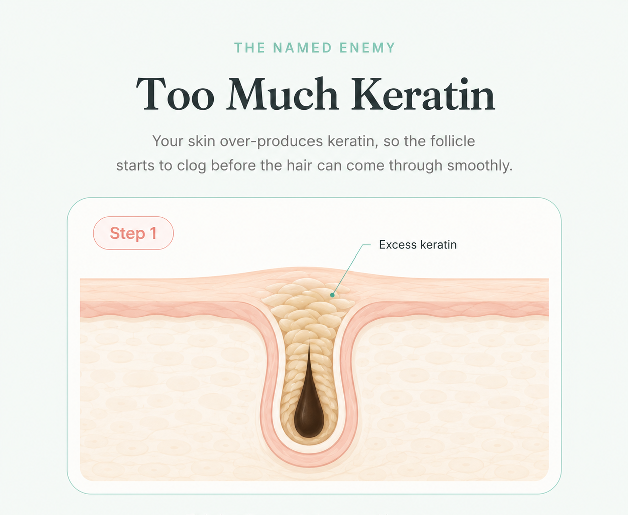 Step 1: excess keratin diagram